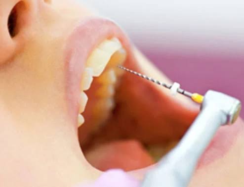 https://ahmedabad-dentist.com/wp-content/uploads/2025/07/WhatsApp-Image-2025-07-01-at-6.05.41-PM.jpeg