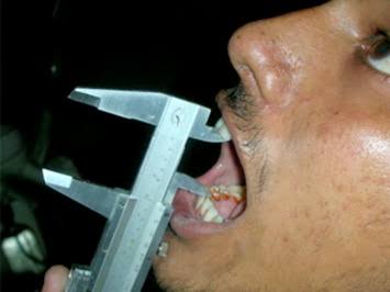 https://ahmedabad-dentist.com/wp-content/uploads/2025/07/WhatsApp-Image-2025-07-26-at-6.06.18-PM.jpeg