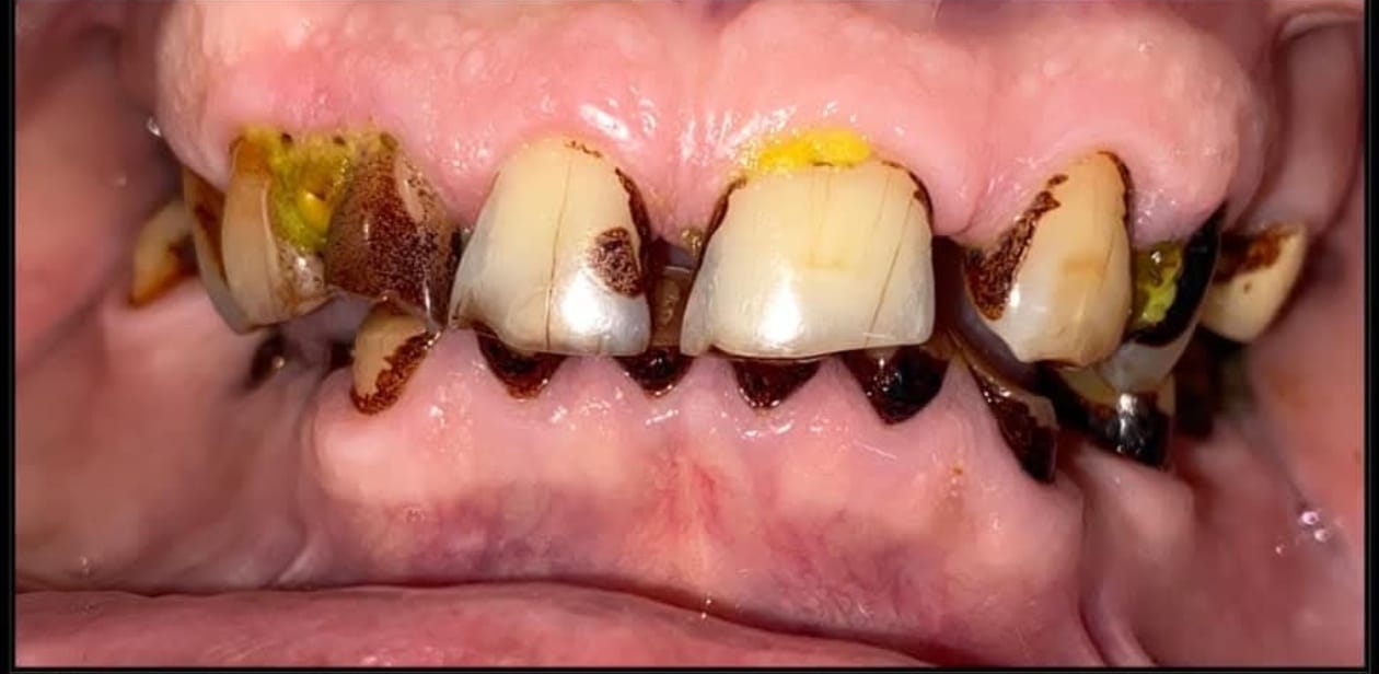 https://ahmedabad-dentist.com/wp-content/uploads/2025/09/WhatsApp-Image-2025-09-19-at-5.02.20-PM-1.jpeg
